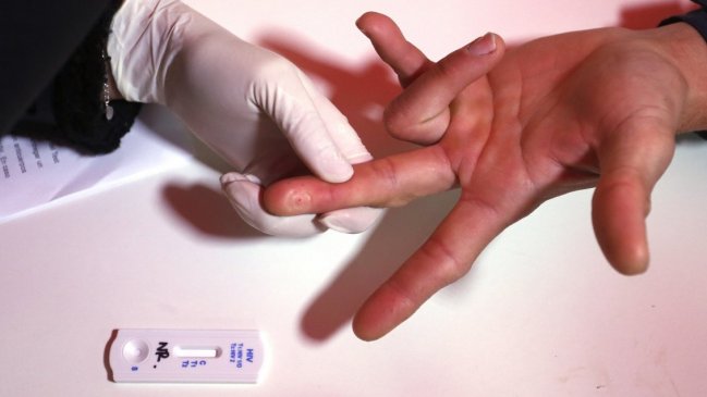 ISP: En 2018 se detectó cifra récord de nuevos casos de VIH