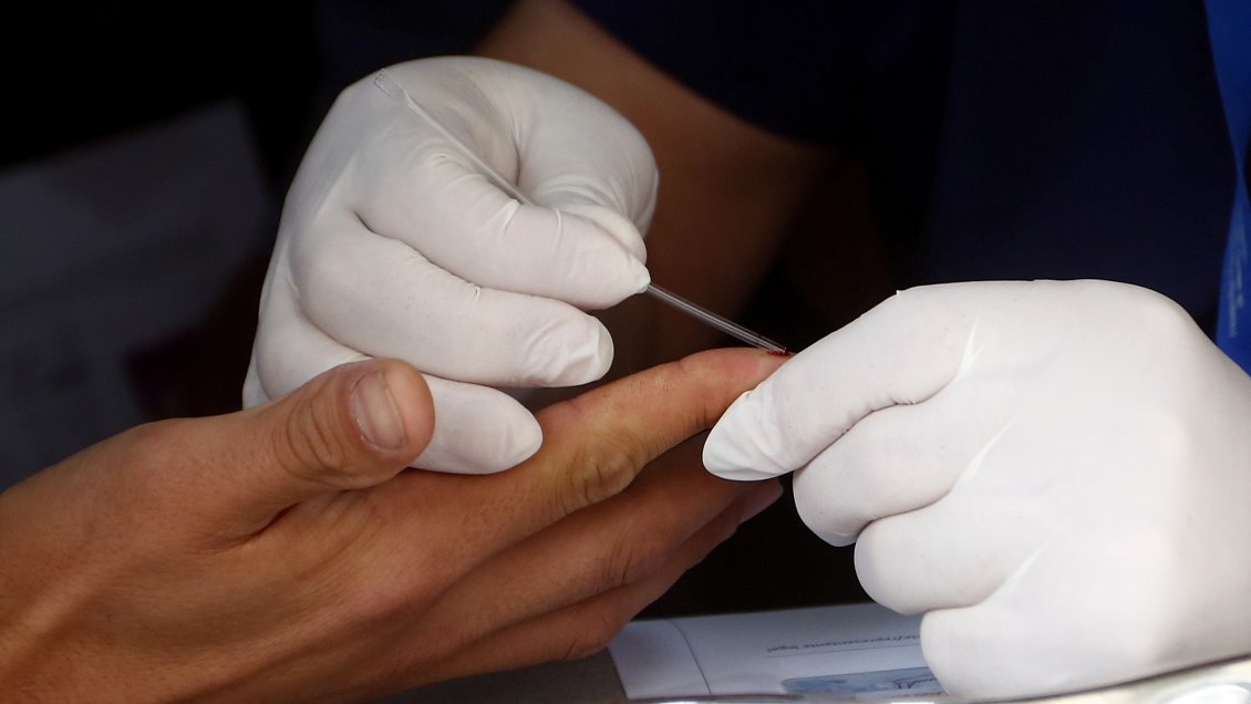 Experto y aumento en casos de VIH: Atribuir todo a los extranjeros no nos hace bien como país