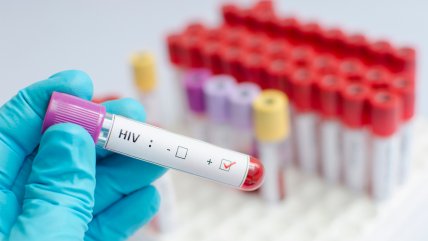   Experto en VIH: Las campañas tienen que ser de mayor impacto 