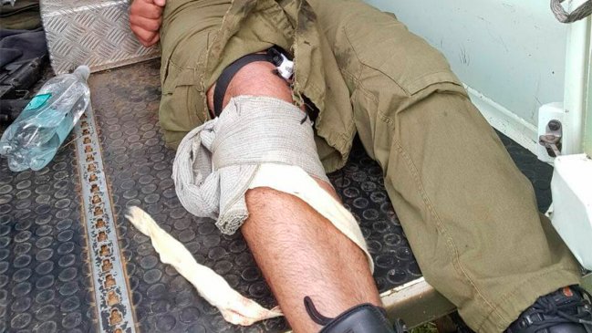 Ex carabinero que recibió disparo de un colega: 