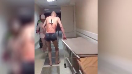Insólito: Pese a tener un cuchillo en la espalda, se arrancó del hospital para ir a fumar