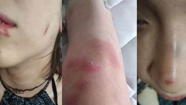 Pareja lésbica denunció brutal ataque homofóbico en Barrio Bellavista