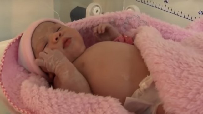 El extraño caso de una bebé que nació 