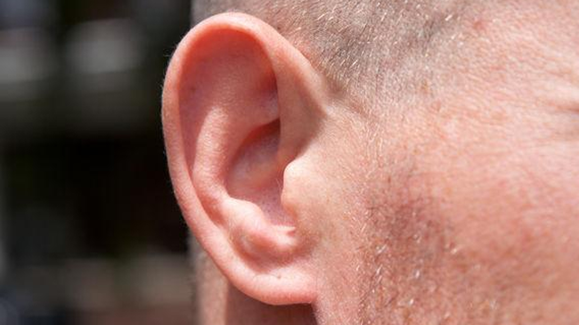 Bolivia: Detienen a dos hombres por arrancar a mordiscos la oreja a su amigo