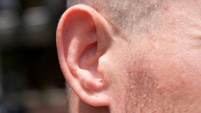 Bolivia: Detienen a dos hombres por arrancar a mordiscos la oreja a su amigo