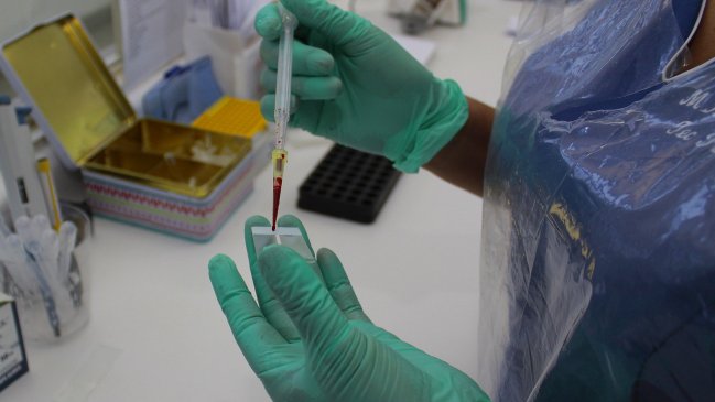 Confirman que hombre que murió en Bulnes contrajo el virus Hanta