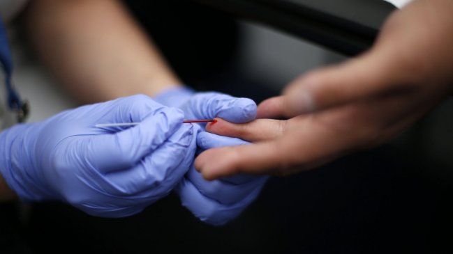 Hospital Clínico de la Universidad de Chile realizará gratuitamente test rápido de VIH