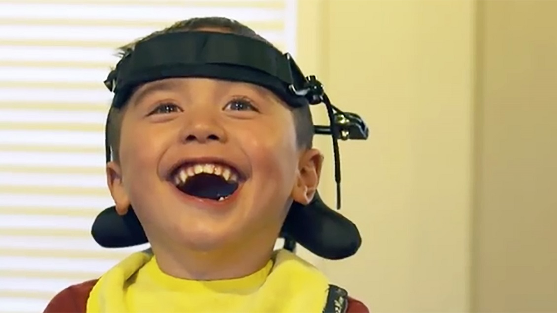 Niño se atragantó con una manzana y quedó paralítico