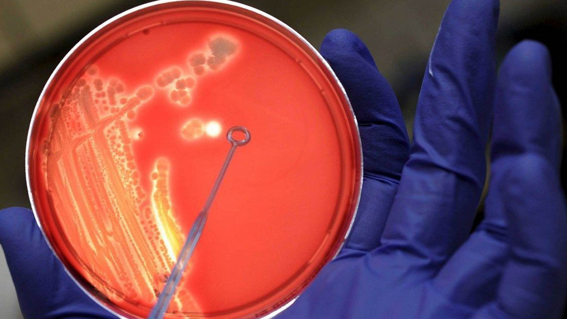 Antibióticos inteligentes: Diseñan 