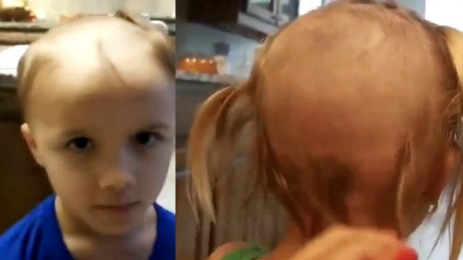 Niño descubrió máquina de afeitar y sufrió las consecuencias con su hermana