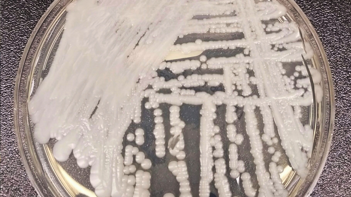 Infectólogo: Es cosa de tiempo para que en Chile tengamos más casos de Candida auris