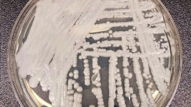 Infectólogo: Es cosa de tiempo para que en Chile tengamos más casos de Candida auris