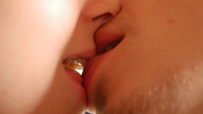 Beso con lengua puede provocar gonorrea según estudio