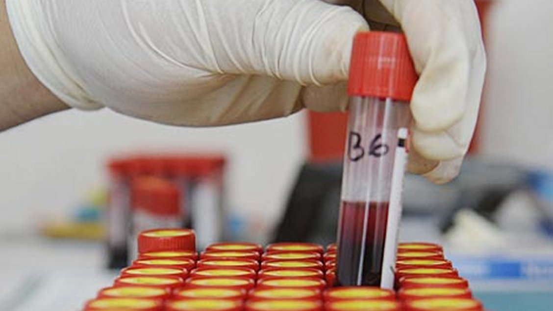 Detectan más de 400 niños contagiados de VIH en un pueblo de Pakistán