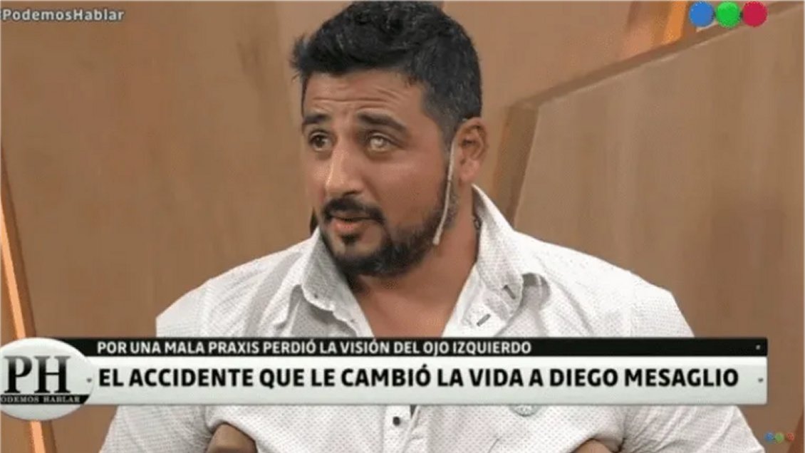 El conmovedor relato de actor argentino que perdió visión en un ojo