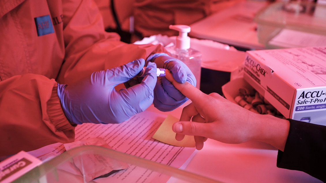 Desarrollan tratamiento que elimina el VIH del genoma de animales vivos