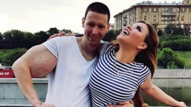 Joven ruso quiso ser musculoso con inyecciones y ahora pide ayuda urgente