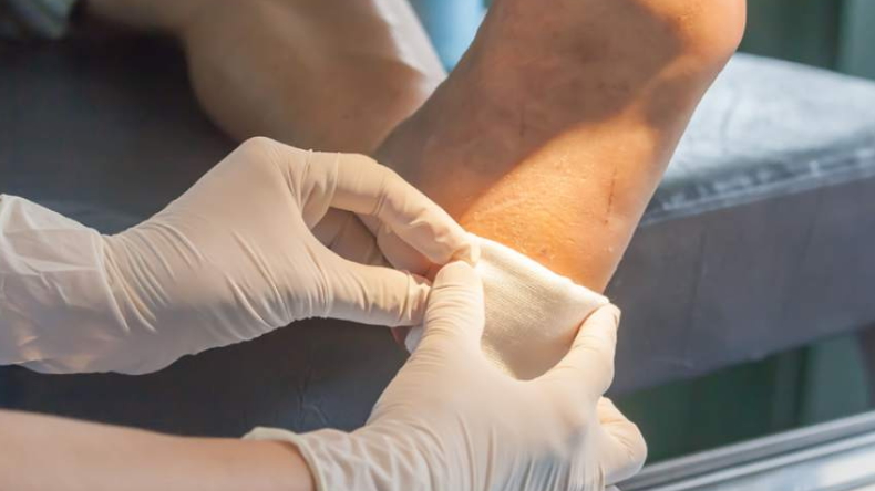 Médicos le amputaron la pierna equivocada a una mujer en Argentina