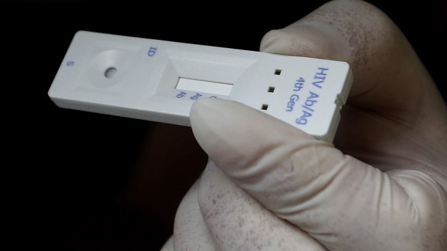 La historia del médico que casi se contagió de VIH por accidente en plena cirugía