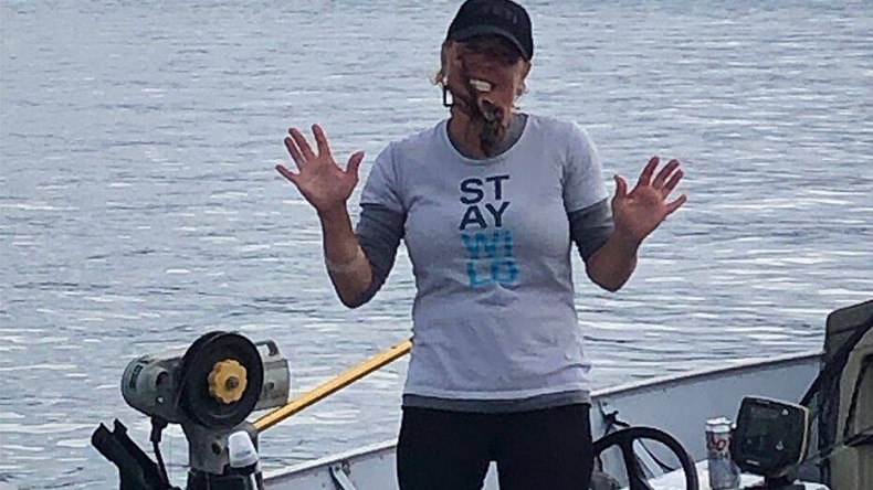 Mujer puso un pulpo en su cara para tomarse una foto y terminó hospitalizada