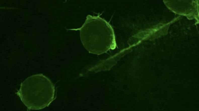 Científicos chilenos revelan mecanismo crucial que explica por qué se mueven las células