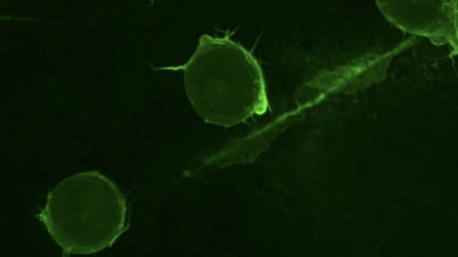 Científicos chilenos revelan mecanismo crucial que explica por qué se mueven las células