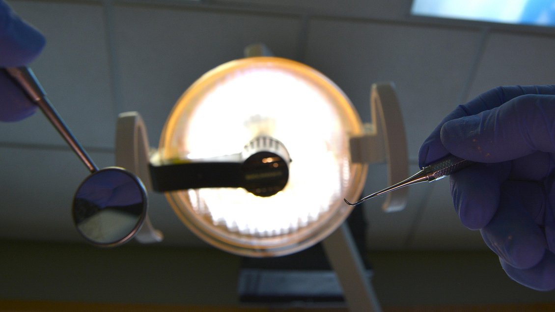 Hombre fue al Hospital Gustavo Fricke a sacarse una muela y terminó con daño cerebral