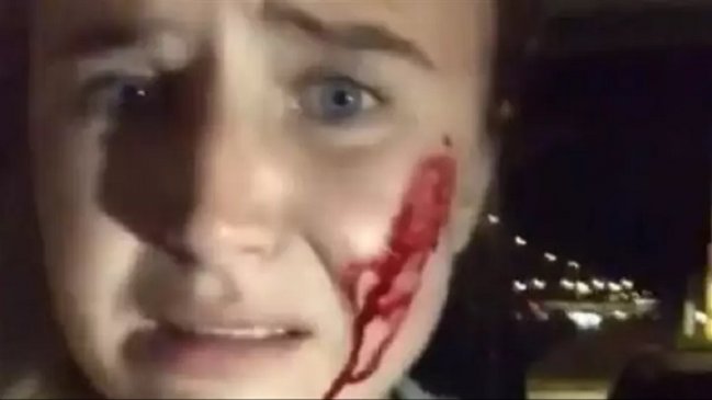 Activista vegana denunció que granjeros le dispararon tras liberar a 16 conejos