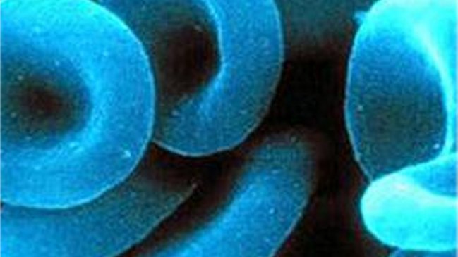 Joven que se automedicó terminó con su sangre de color azul