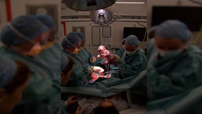 Desaconsejan parto vaginal a mujeres que antes han dado a luz por cesárea