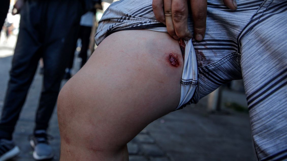 Defensora de la Niñez denunció dificultades para visitar a niños heridos en manifestaciones