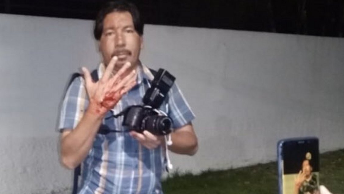 Fiscalía tomó declaración a reportero herido por 