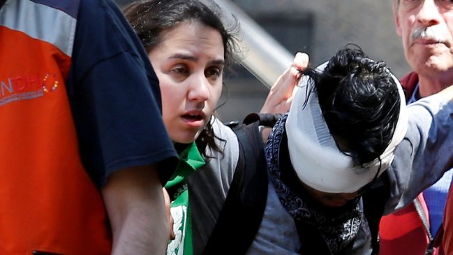 Fiscalía investiga caso de joven que sufrió una lesión ocular en Puerto Montt