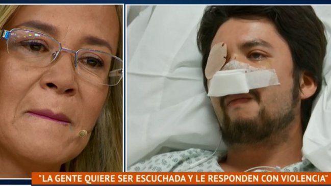 El conmovedor testimonio de joven que perdió un ojo por el impacto de una lacrimógena