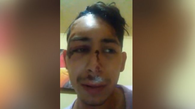Joven de Puerto Montt relató en un video que cuatro hombres lo golpearon y lo violaron