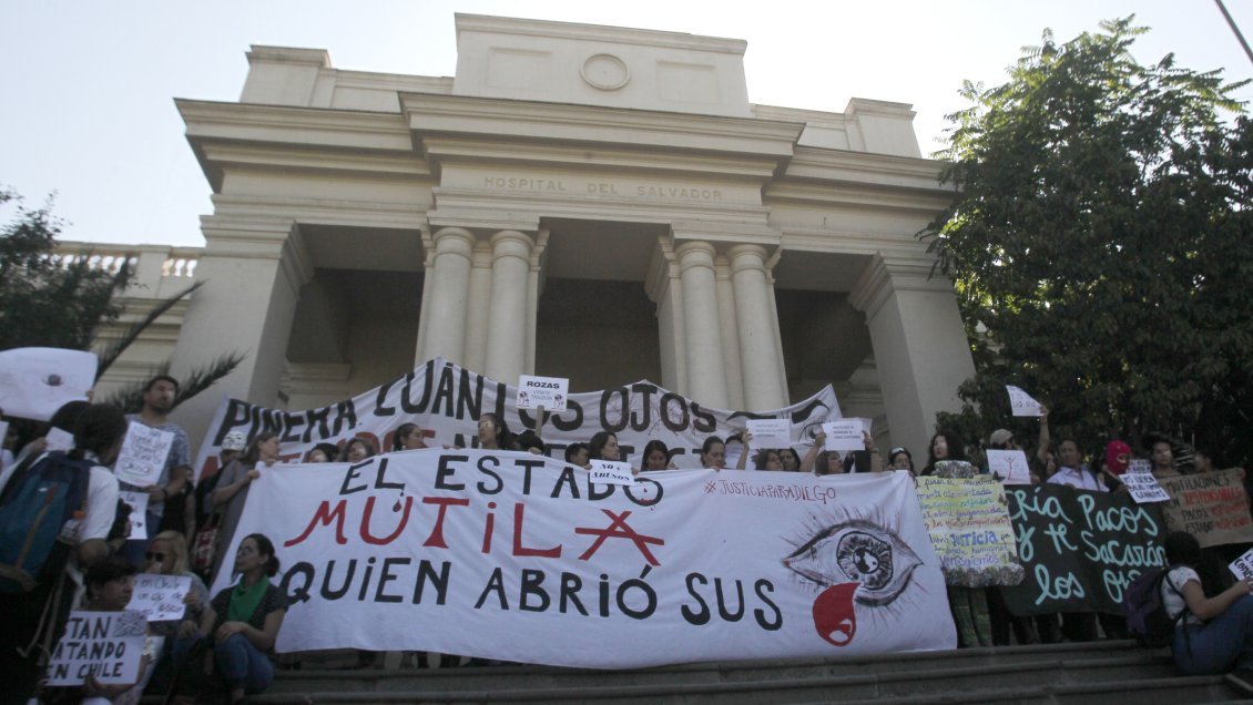 Colegio Médico asegura que 360 personas han sufrido trauma ocular desde el inicio de la crisis
