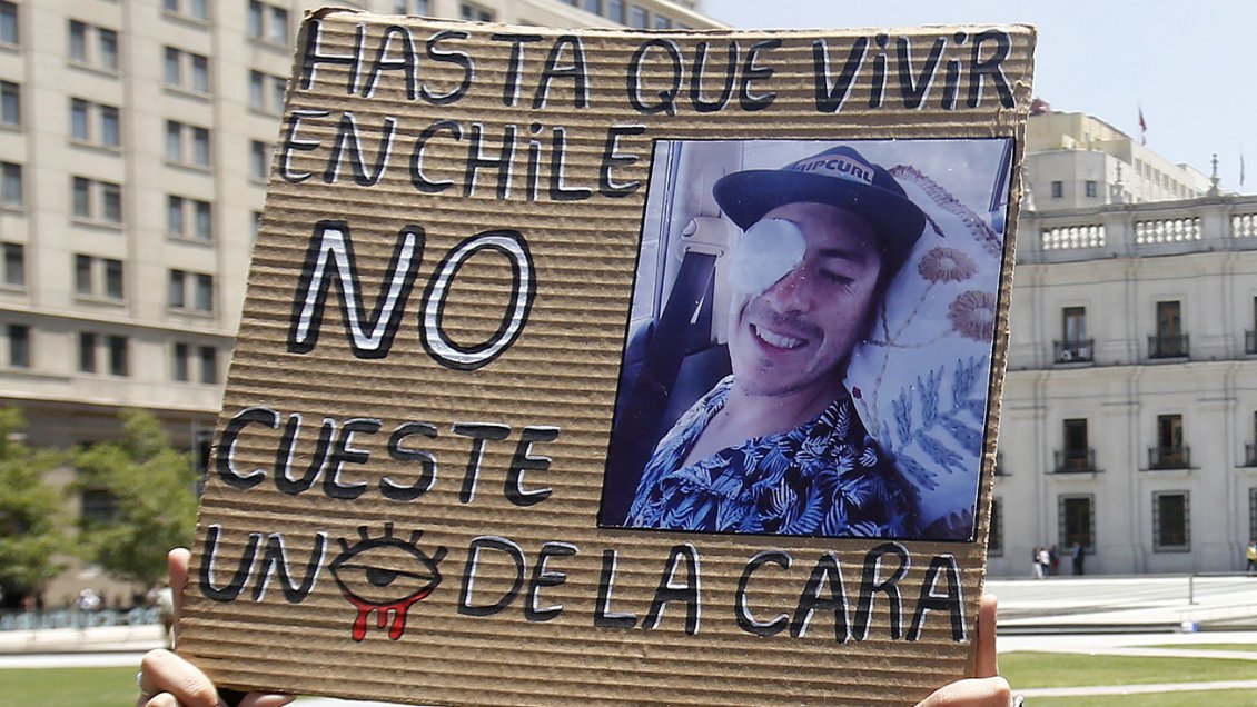 Colegio Médico pide al Estado medidas para evitar nuevos casos de trauma ocular