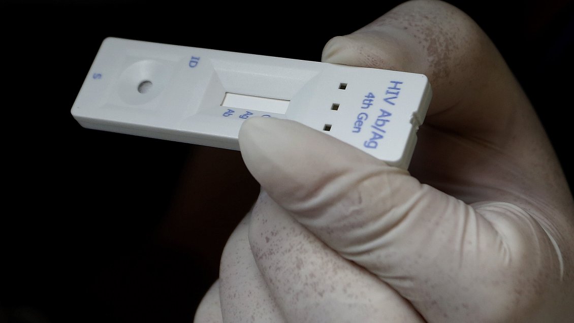 Test rápidos y gratuitos de VIH en playas y plazas del Biobío durante este verano