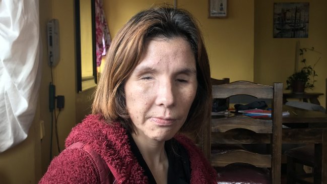 Inician campaña para reunir fondos que le permitan a Nabila Rifo vivir en Santiago