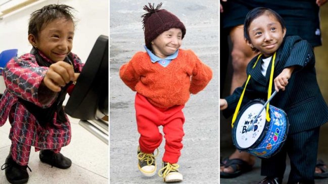 Falleció a los 27 años el hombre más pequeño del mundo
