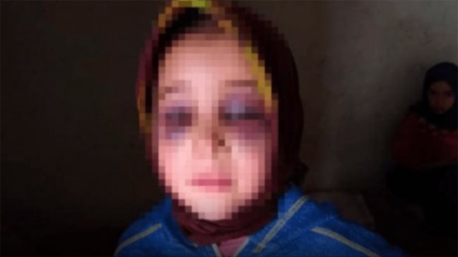 Condenan a profesor que golpeó a una estudiante de ocho años en Marruecos