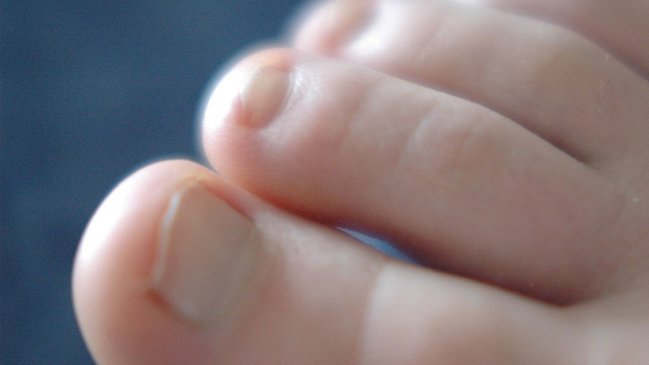 Acusan a trabajador de un hospital de chupar los dedos de un paciente