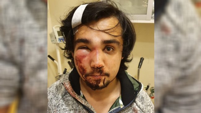 Este viernes debe declarar ante la PDI el joven del PS que denuncia brutal golpiza de Carabineros