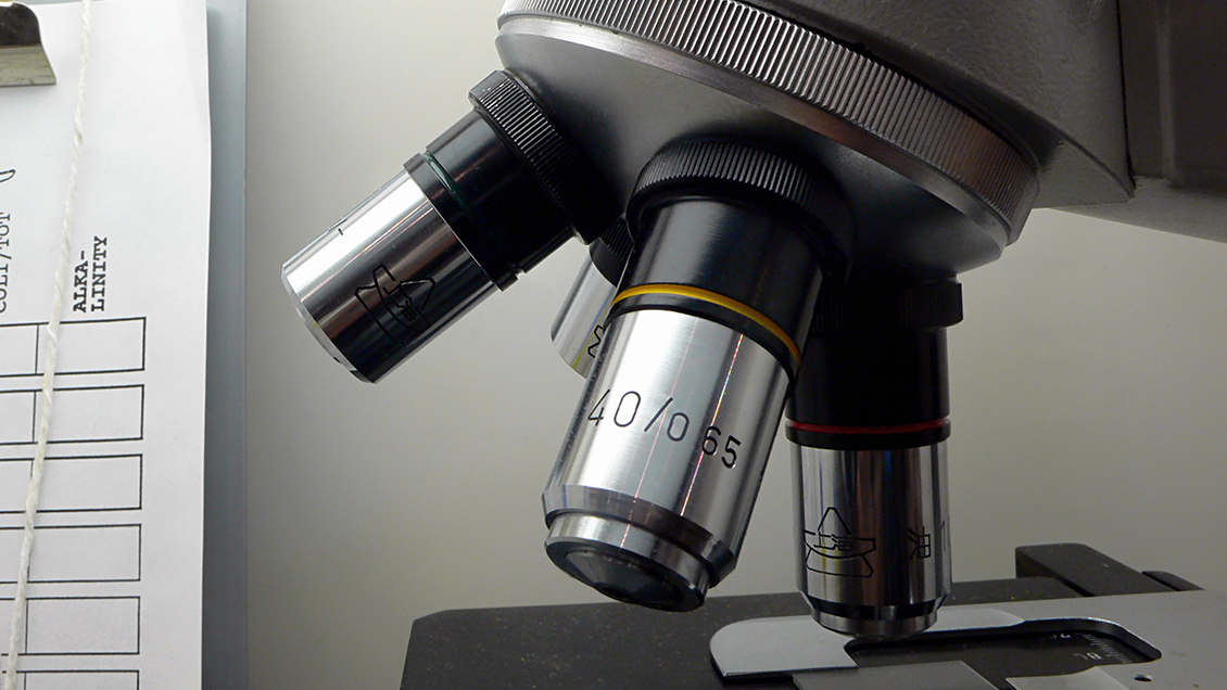 Tests de saliva podrían ser un 