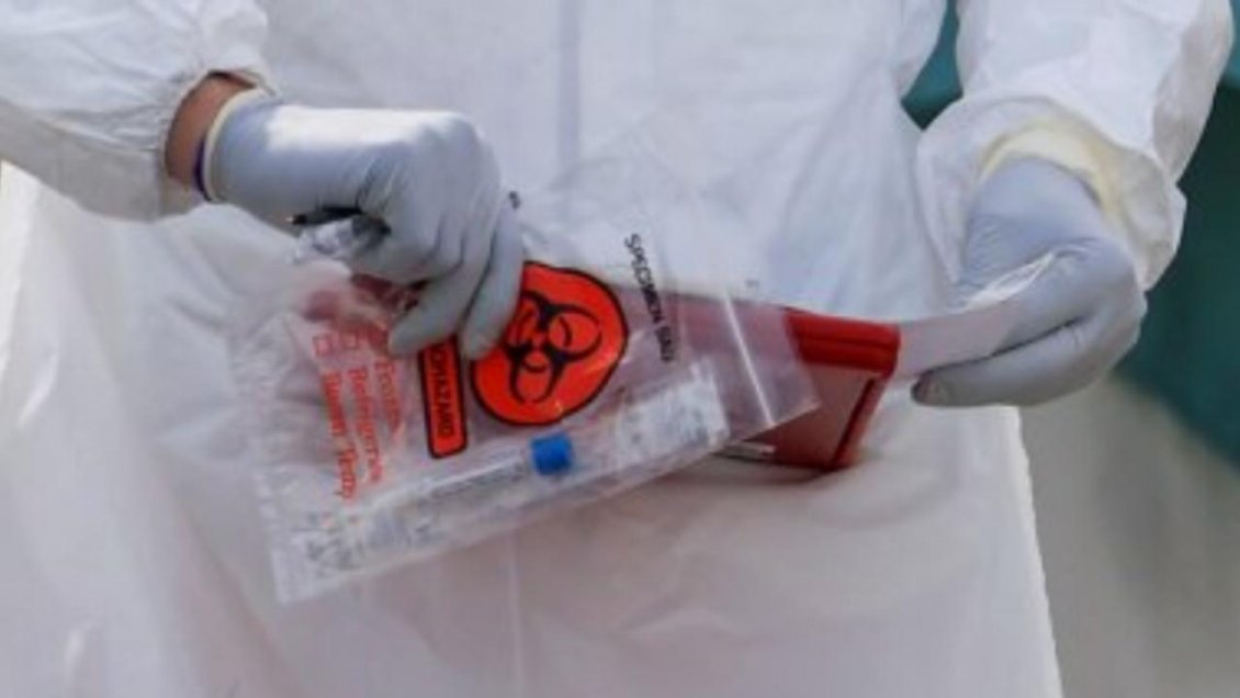 Trabajador de Minera Escondida dio positivo a Covid-19