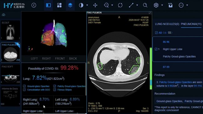 Ex Posta Central usa inteligencia artificial para confirmar en minutos casos de coronavirus