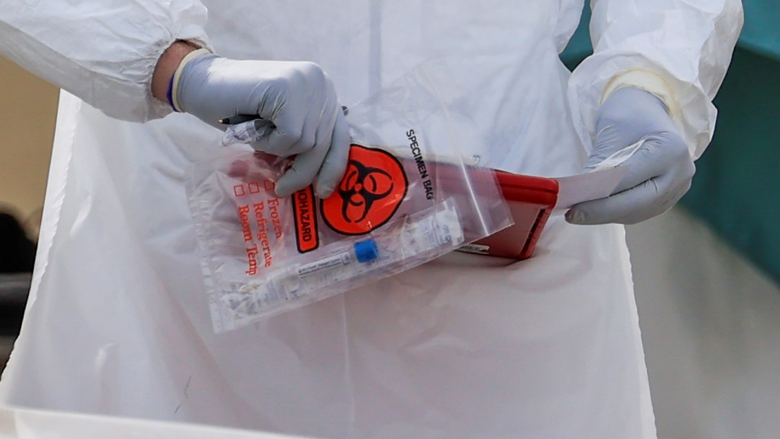 Epidemiólogo: Situación del Covid-19 en Chile 