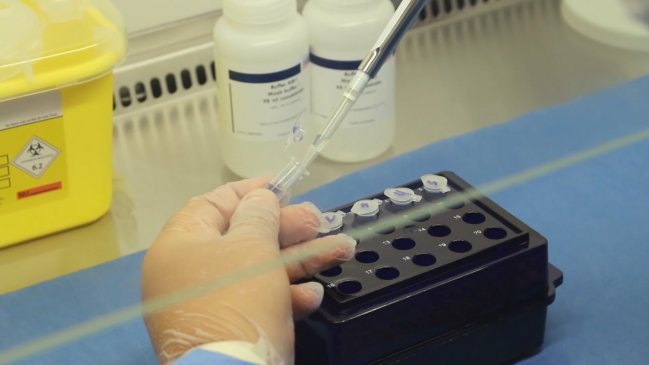 Más de 400 exámenes de Covid-19 aún esperan análisis por fallas en laboratorio de Ovalle