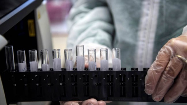 Enzima puede explicar por qué los hombres tienen más probabilidad de morir por Covid-19