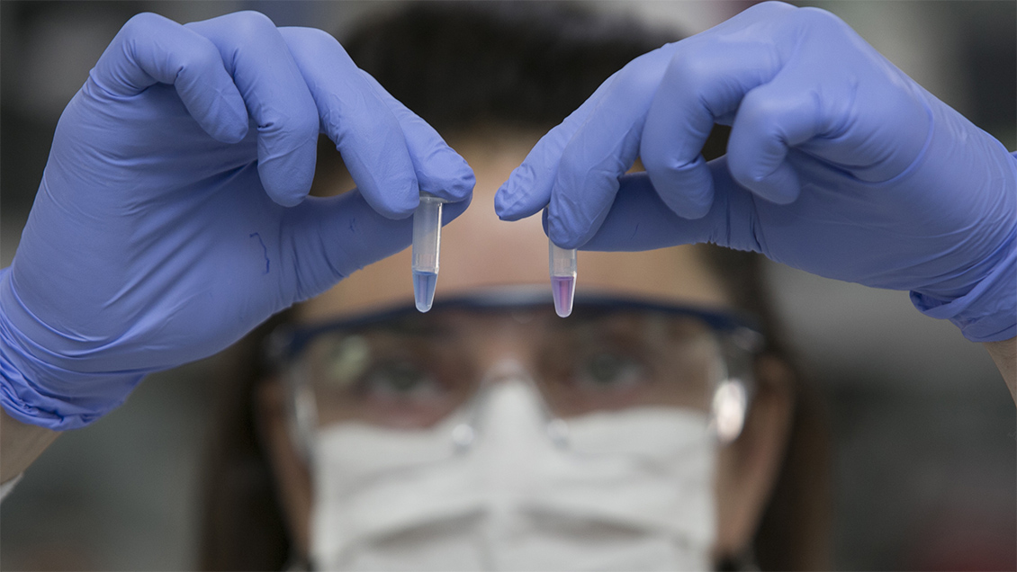 Argentina creó test que detecta Covid-19 en una hora